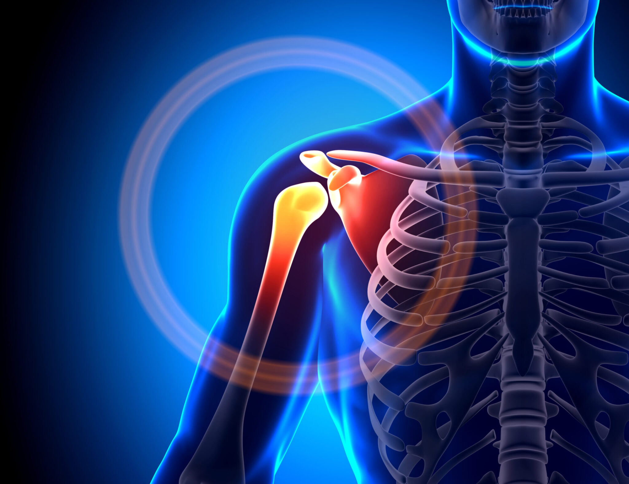 Shoulder injury