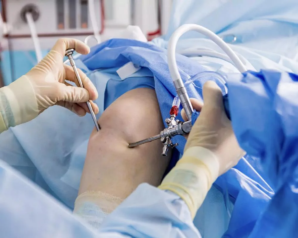 orthopedic-including-arthroscopy